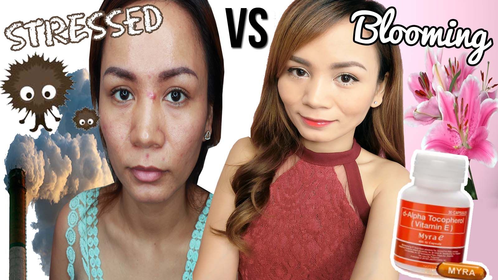 Real Asian Beauty MYRA Vitamin E Benefits on ACNE Prone Skin RealAsianBeauty Acne